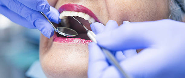 Best Emergency Dental Care for Broken or Chipped Teeth in USA